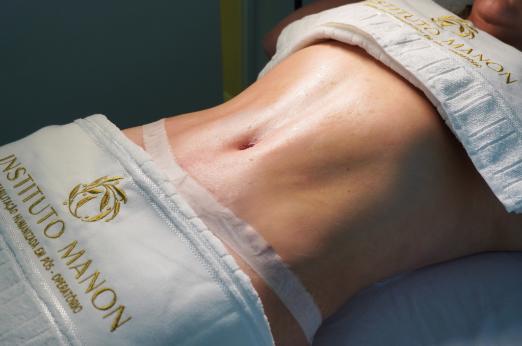 Seu corpo, seu tempo: o que esperar das primeiras semanas de recuperação da abdominoplastia