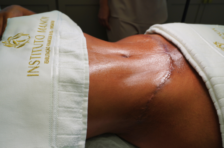 Ansiedade pelo resultado: quando ela atrapalha o seu pós-operatório