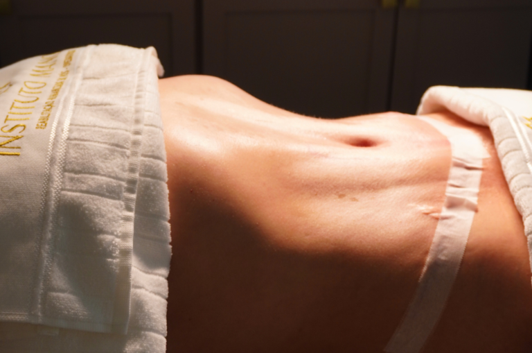Quanto tempo demora para desinchar após a abdominoplastia?